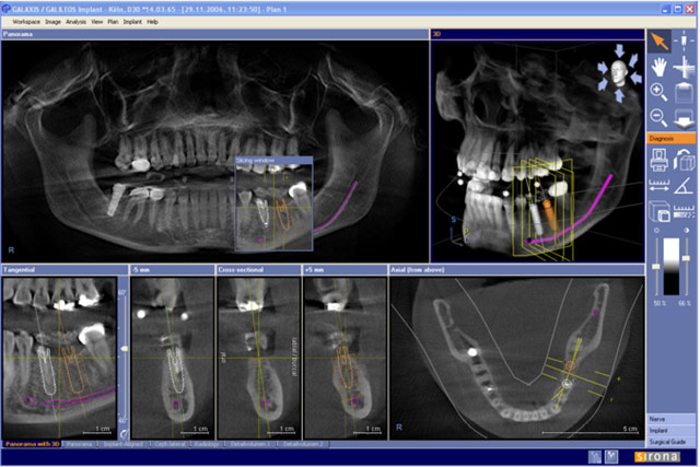 Immagine-3d-sirona