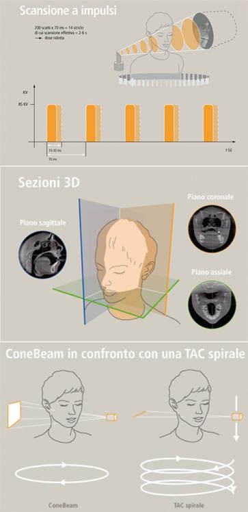 Tac-Cone-Beam